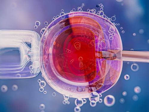 IVF Industry